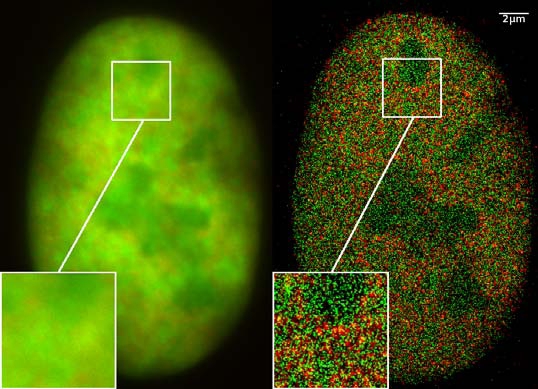 On left: what we used to see with our best microscopes. On right: what we can see now!