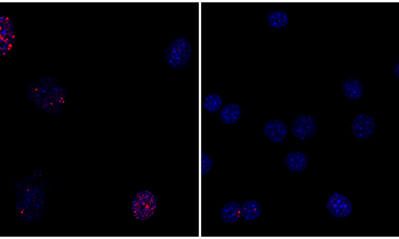 Salk Institute researchers discover that partial cellular reprogramming reversed cellular signs of aging such as accumulation of DNA damage. (Left) Progeria mouse fibroblast cells; (right) progeria mouse fibroblast cells rejuvenated by partial reprogramming. Credit: Salk Institute
